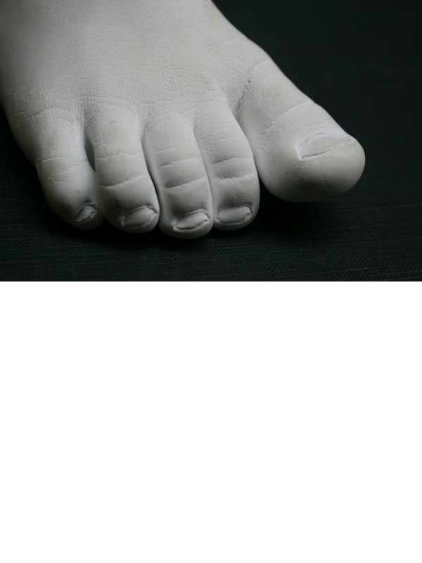 Foot cast made from Quartzite - Skin paste was used to make the mold